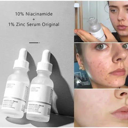 The Ordinary Niacinamide 10% + Zinc 1% - 30ml Velvet Prime
