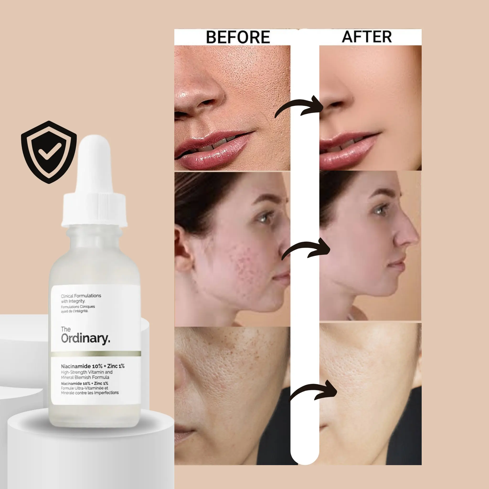 The Ordinary Niacinamide 10% + Zinc 1% - 30ml Velvet Prime