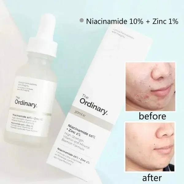 The Ordinary Niacinamide 10% + Zinc 1% - 30ml Velvet Prime